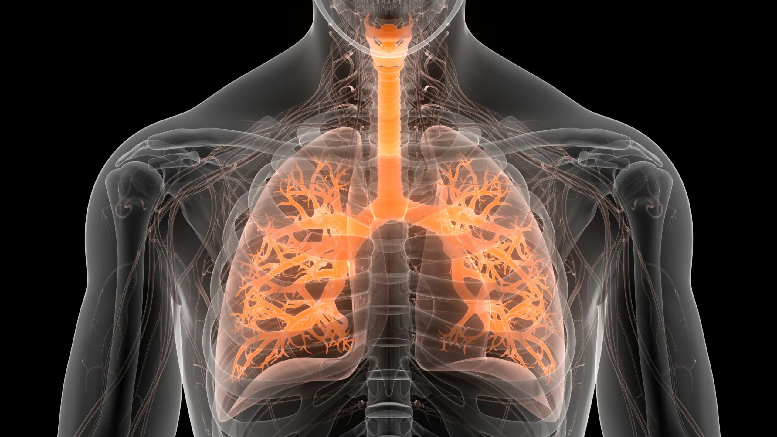 Pulmonary Fibrosis Treatment in Greater Noida