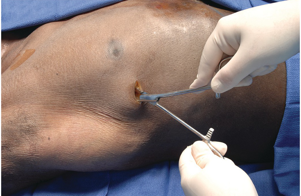 Chest specialist Doctor in Greater Noida